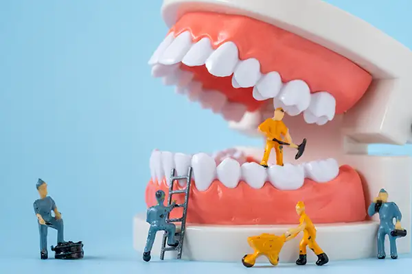 Miniature figures working around an oversized denture model, illustrating a playful concept of denture care and maintenance.